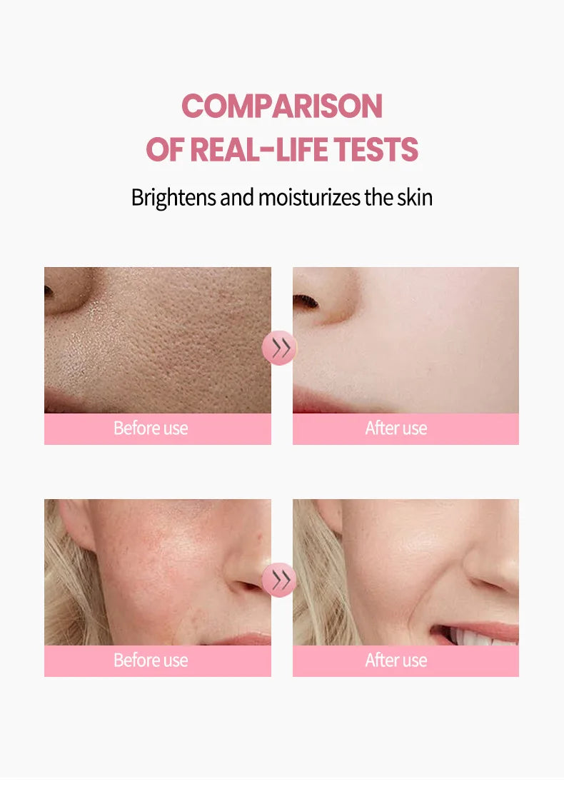 Before and after skin test showing reduced pores and redness, resulting in a brighter, moisturized appearance.