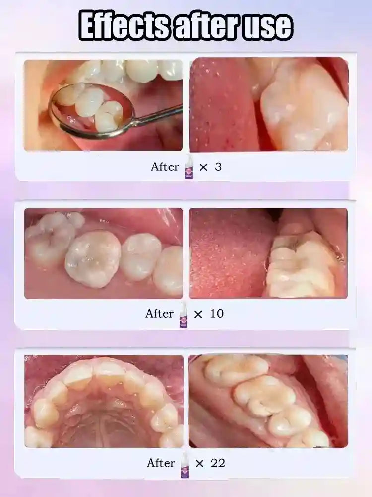 Tidesmit teeth whitening serum for cavity repair and tooth decay protection with colour correcting formula