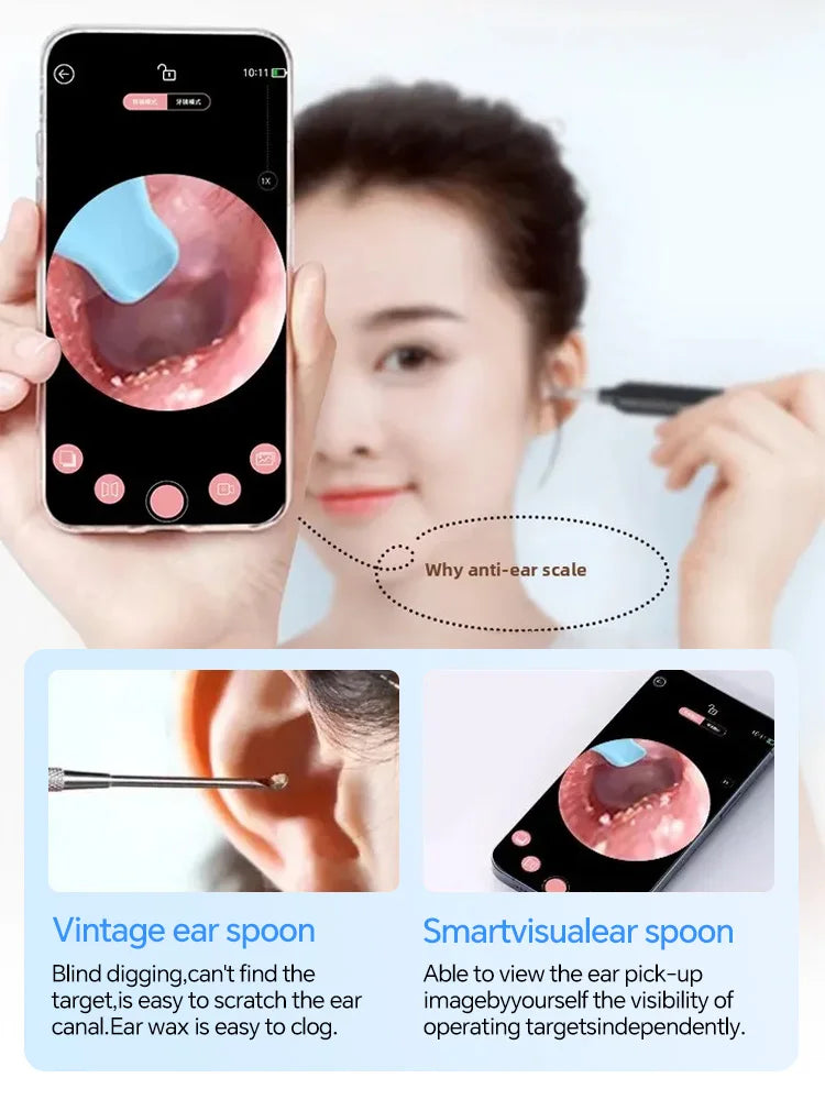 Visual Ear Wax Cleaner Camera - Digital HD Earwax Removal Kit Relaxation Treatment Tidesmit