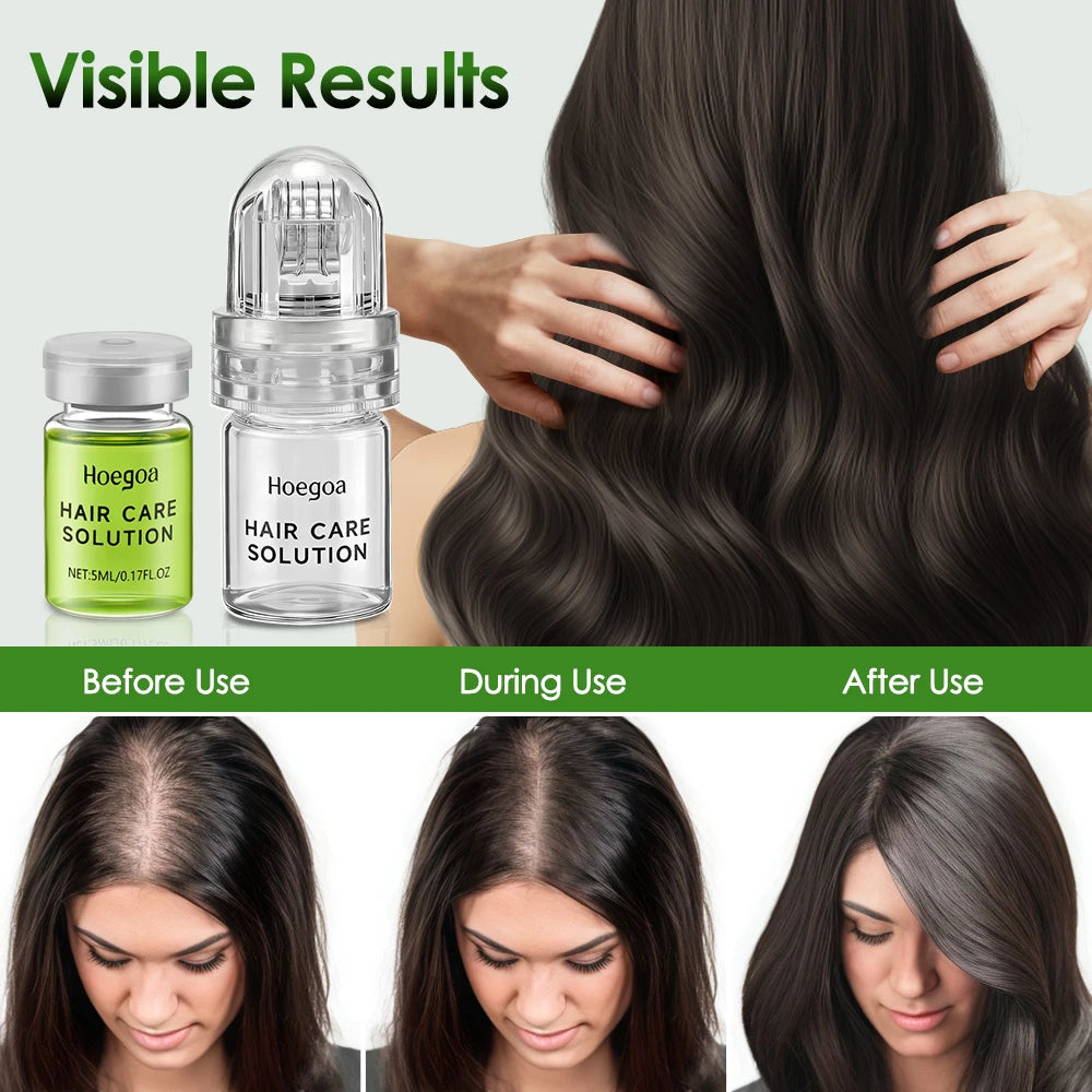 Tidesmit Ginger Hair Growth Oil for thicker, faster hair regrowth and root strengthening hair loss treatment results.