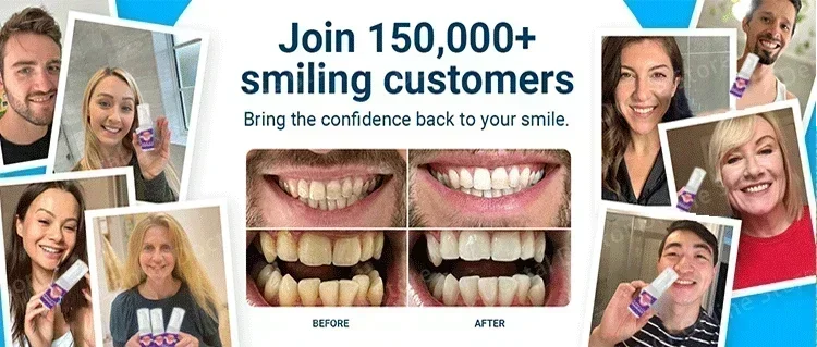 Tidesmit teeth whitening and cavity repair kit for plaque removal and dental enamel protection