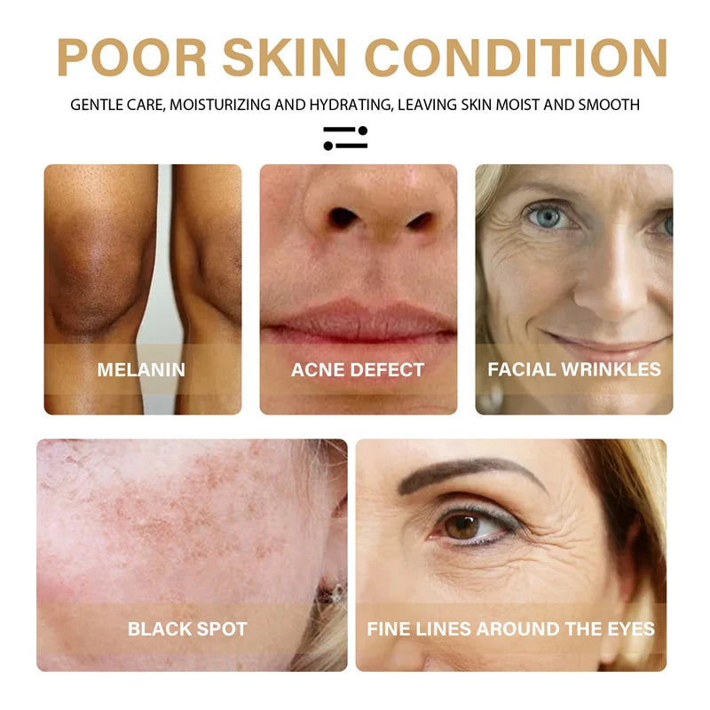 Turmeric Face Serum Shrink Pore Essence Repair Melanin Brighten Moisturizing Nourish Cur-cumin Oil Fade Dark Spot Skin Care