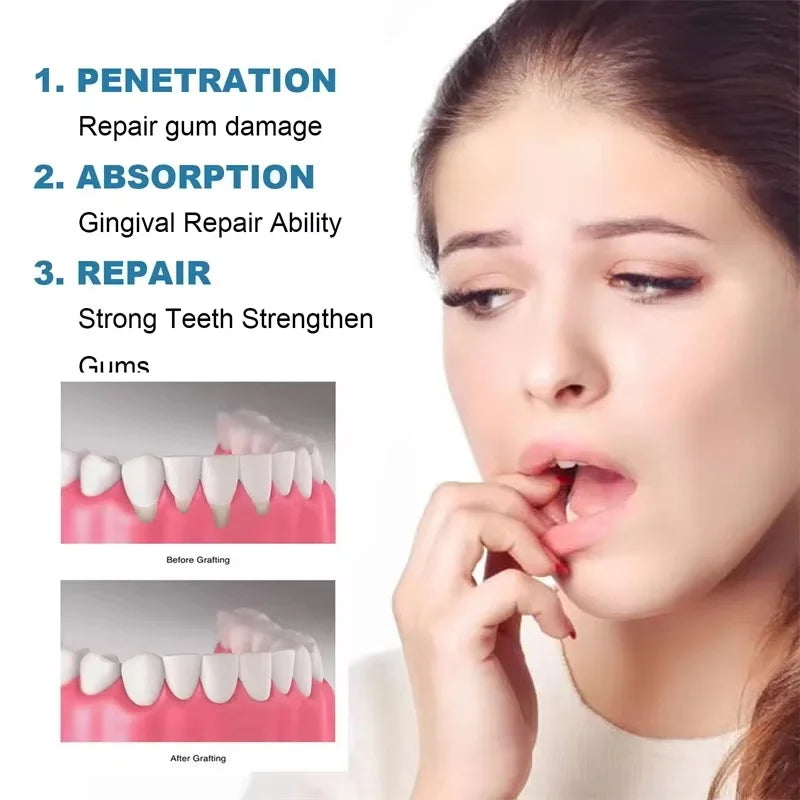 Tidesmit Rapid Repair Gum Serum for tooth sensitivity, dental caries, and whitening treatment.