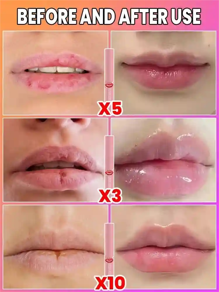 Lip Plumper Serum - Natural Volume Boost & Hydrating Lip Treatment Lip Care Tidesmit