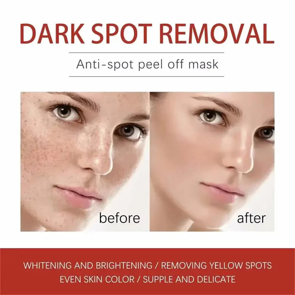 Before and after comparison of a woman's face, showing skin with dark spots and clearer, brighter skin after treatment.