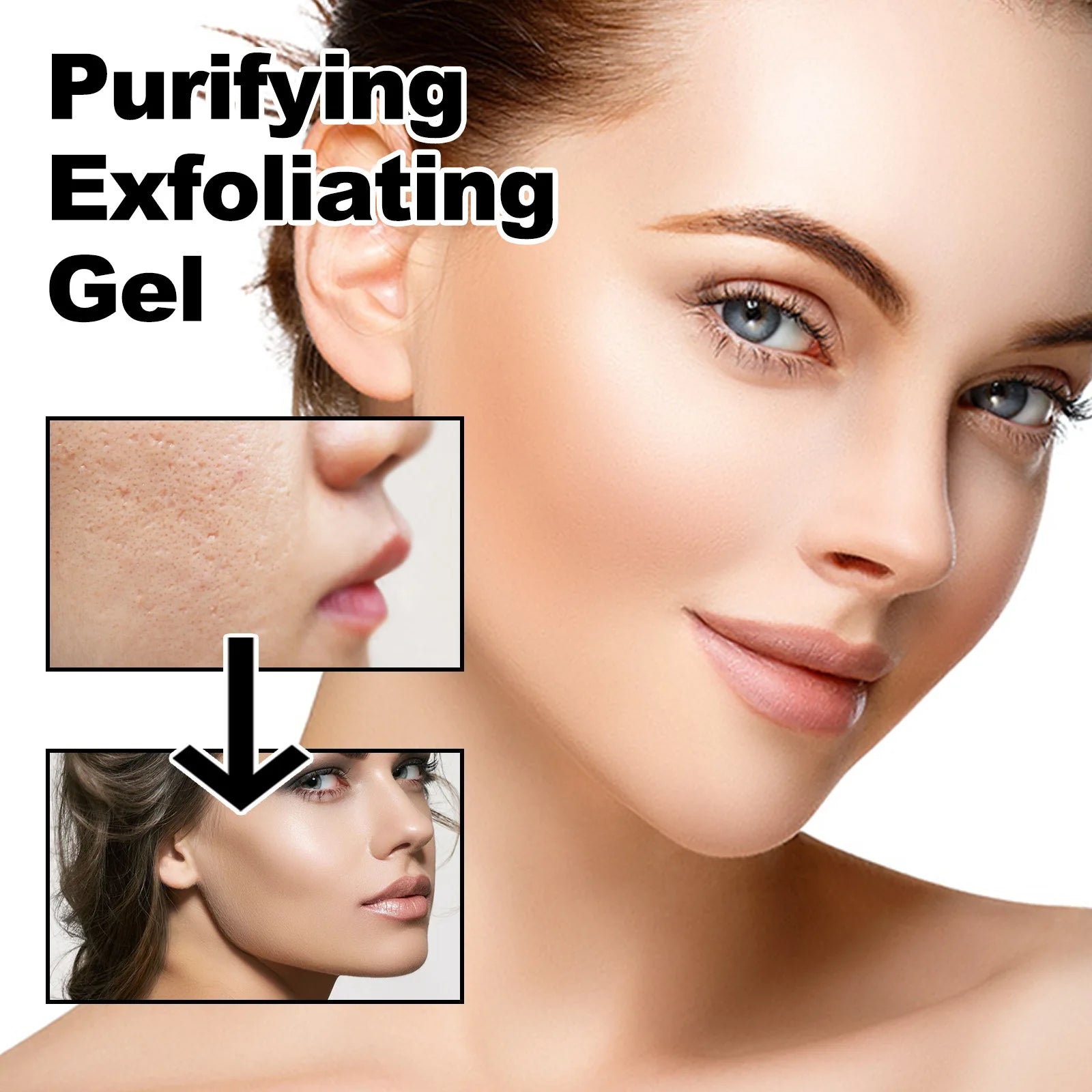 Exfoliating Peeling Gel for Acne and Blackheads - 50g Gentle Formula Scrubs Treatments Tidesmit