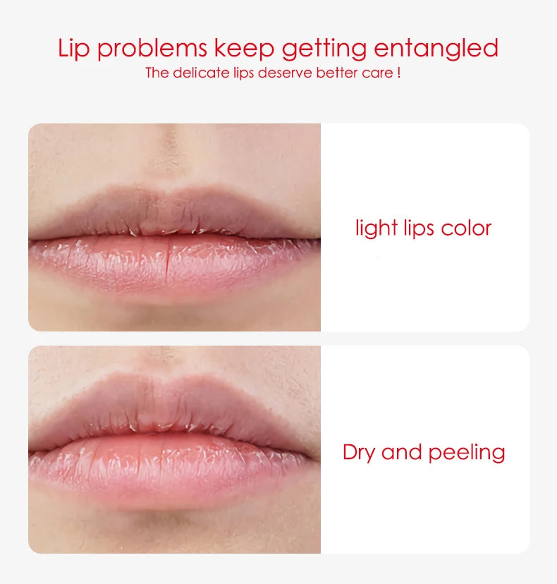 Moisturizing Lip Balm Jelly Treatment for Dry Lips - Tidesmit Lip Care Tidesmit