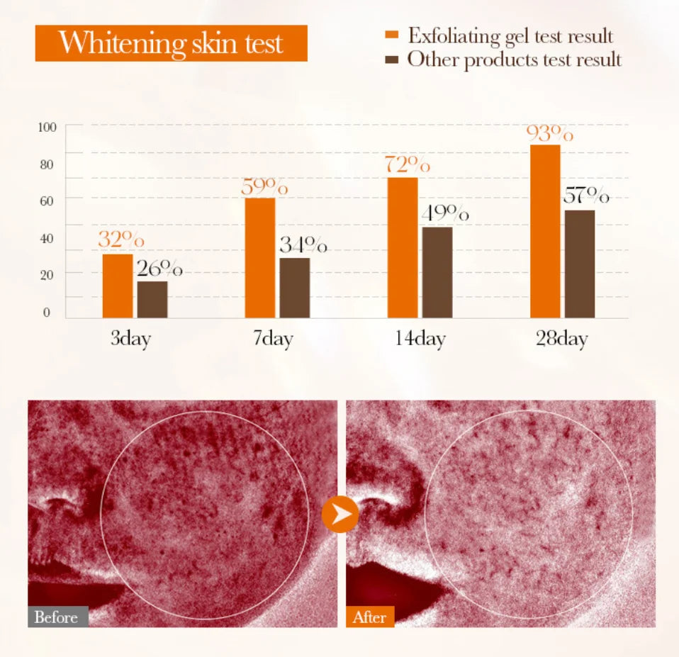 Orange Exfoliating Peeling Gel - Natural Salon-Quality Skin Resurfacing Scrubs Treatments Tidesmit