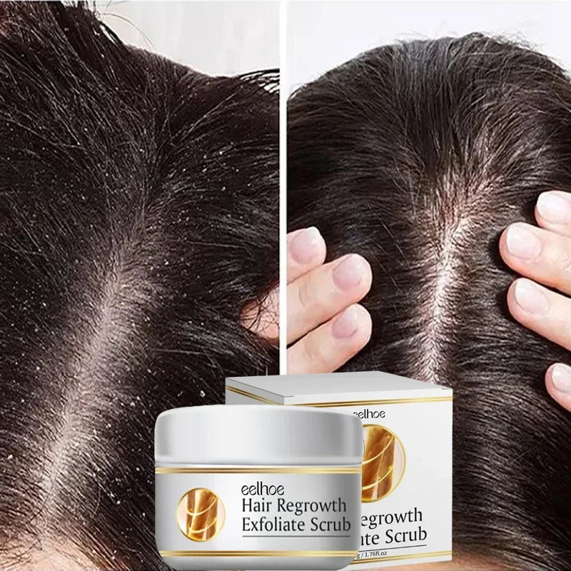 Anti Dandruff Scalp Scrub Treatment for Itch Relief - Tidesmit Scrubs Treatments Tidesmit