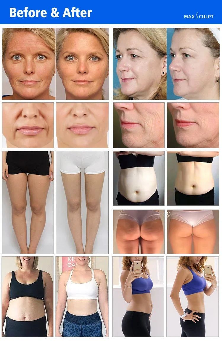 Vacuum Body Shaping Machine for Cellulite Reduction and Skin Lifting Body Shaping Massage Equipment Tidesmit