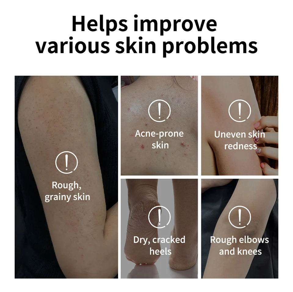 Glycolic Acid Exfoliating Body Stick for Smooth Skin - Tidesmit Scrubs Treatments Tidesmit