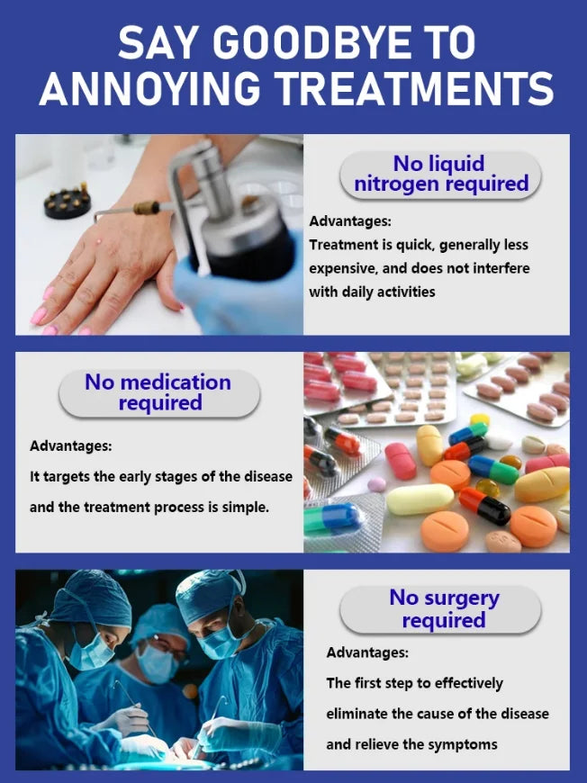 Blue Light Wart Removal Tool - Portable LED Skin Therapy Device Relaxation Treatment Tidesmit