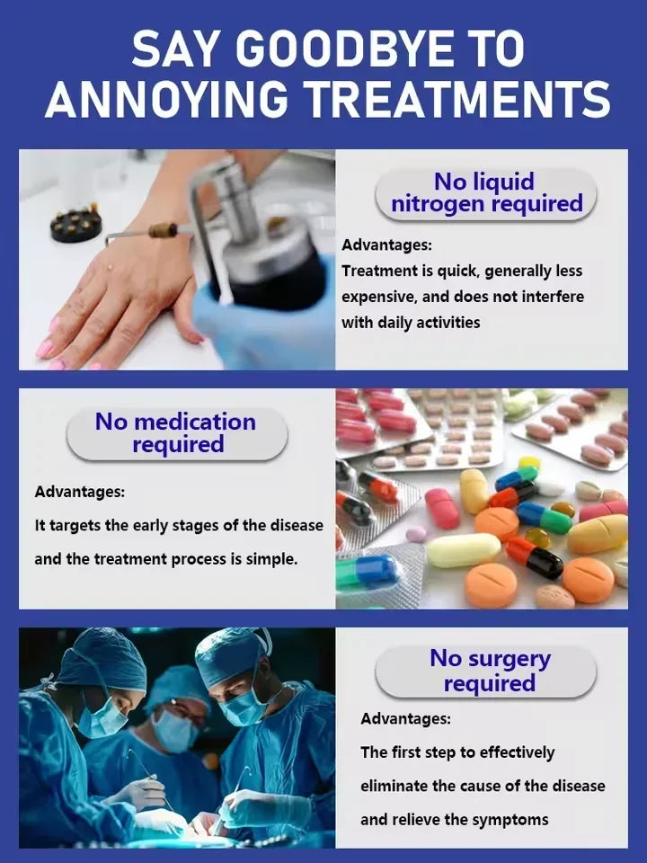 Blue Light Wart Removal Tool - Portable LED Skin Therapy Device Relaxation Treatment Tidesmit