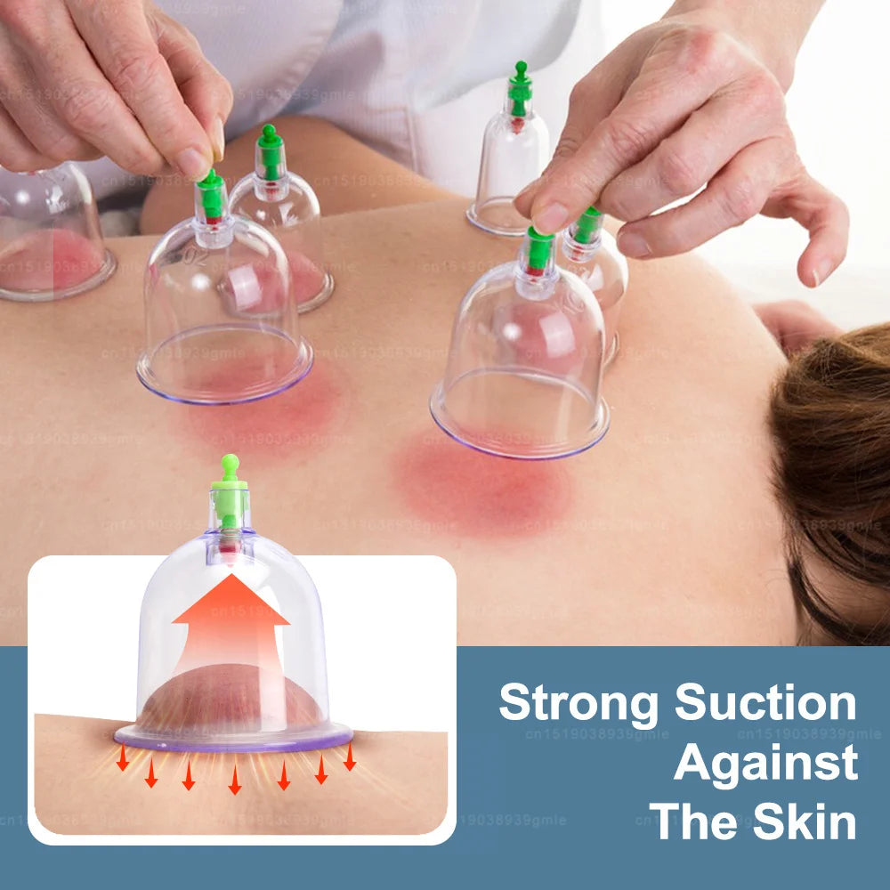 Electric Cupping Therapy Set for Back Massage | 12-Piece Wellness Kit Relaxation Treatment Tidesmit