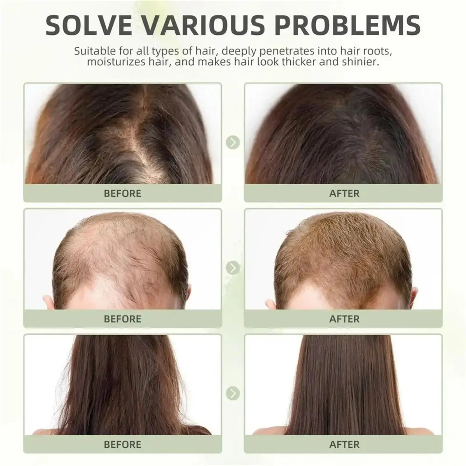 Tidesmit hair growth serum capsules: Before and after results for anti-hair loss, scalp repair, and thicker hair regrowth.