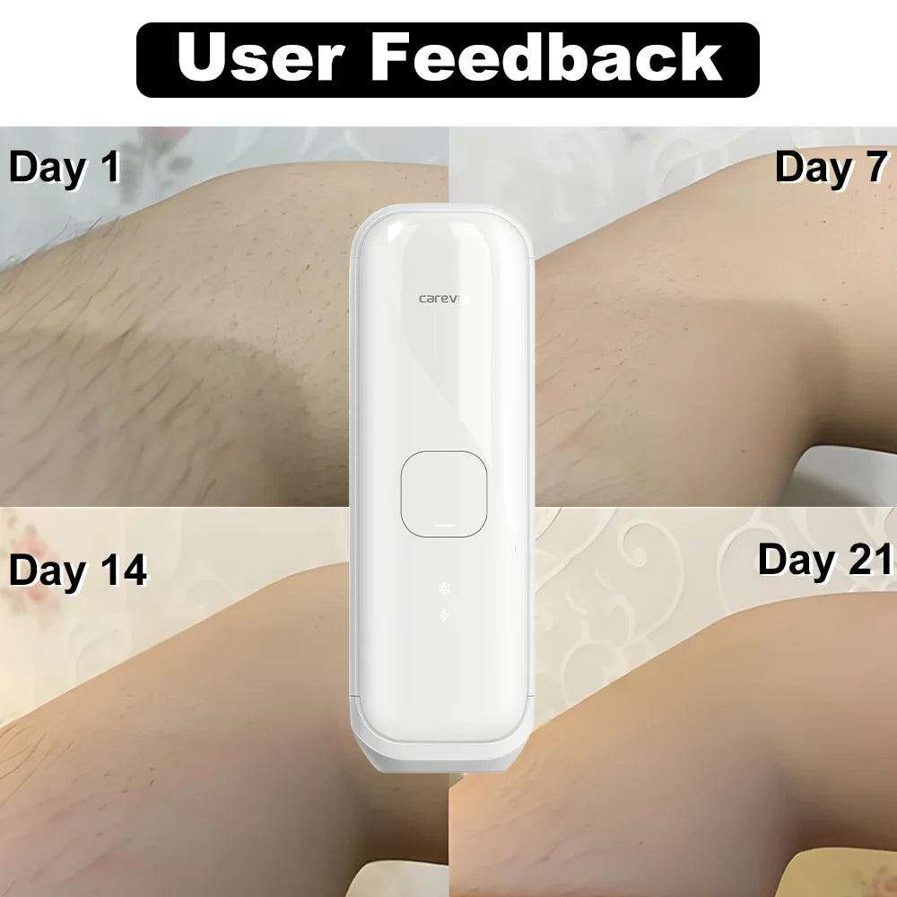 White, vertical IPL hair removal device overlaid on a collage showing skin progress from Day 1 to Day 21.