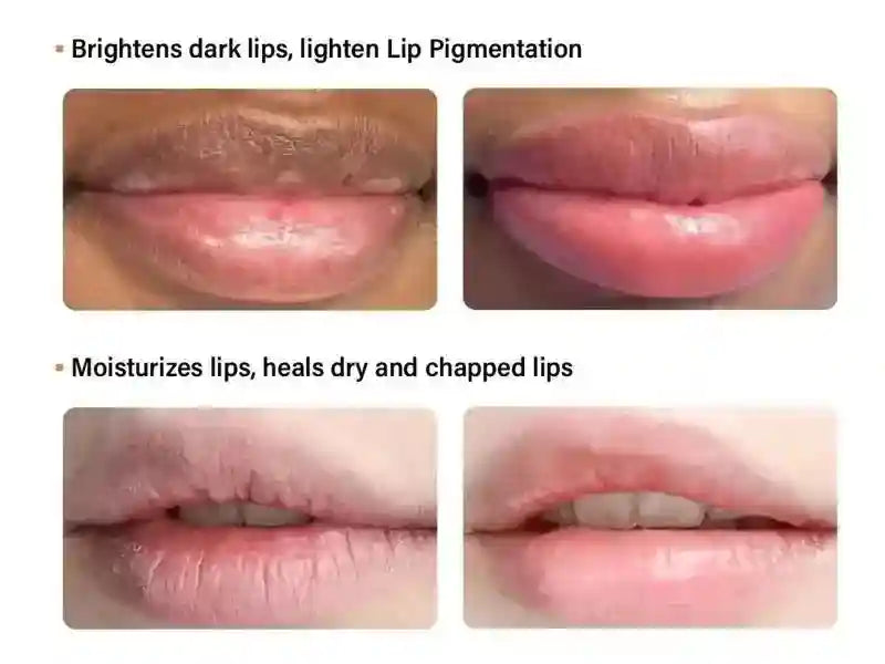 Dark Lip Moisturizing Balm - Targeted Melanin & Line Treatment Lip Care Tidesmit