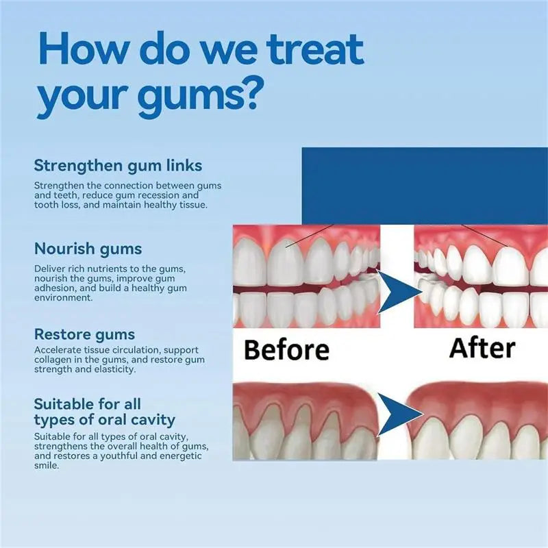 Tidesmit gum repair and teeth whitening gel for treating gingival inflammation and removing surface tooth stains