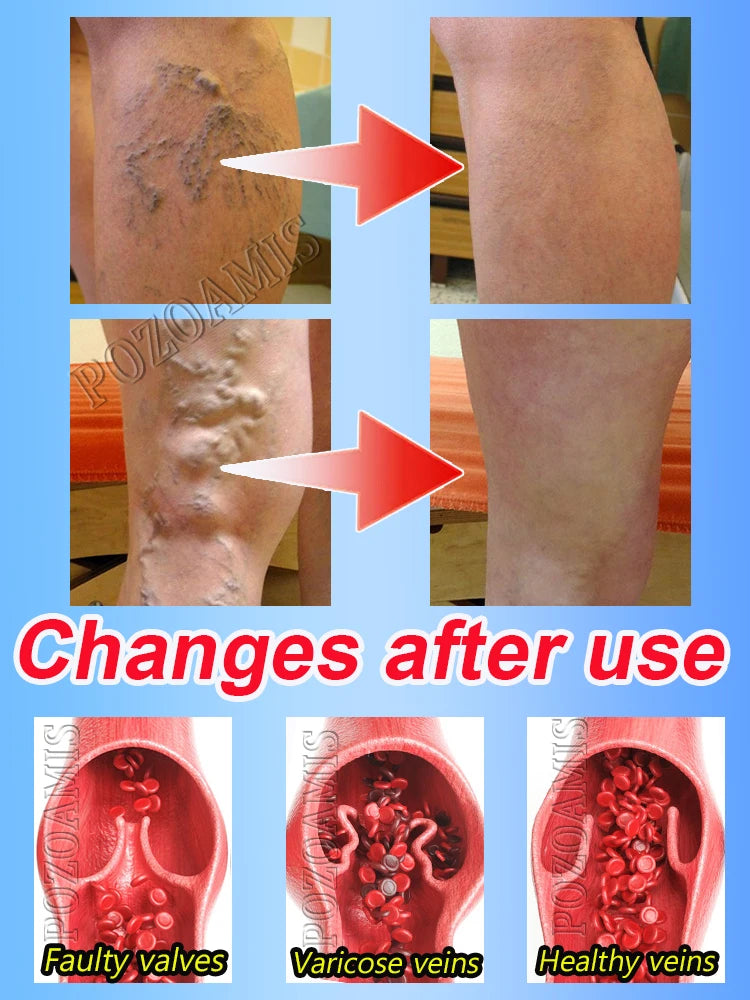 Portable Relaxation Therapy Device - Compact Home Wellness Tool Relaxation Treatment Tidesmit