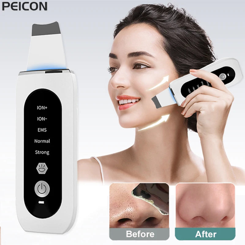 Ultrasonic Skin Scrubber – Professional Pore Cleansing Facial Tool Scrubs Treatments Tidesmit