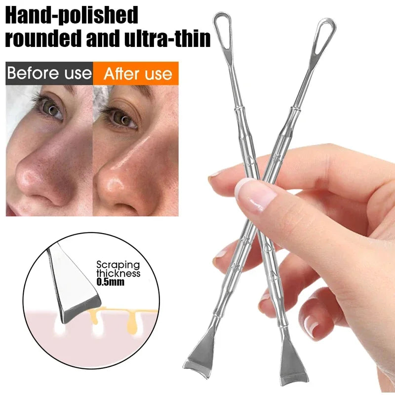 Blackhead Remover Tool Kit 4pc - Professional Stainless Steel Acne Set Scrubs Treatments Tidesmit