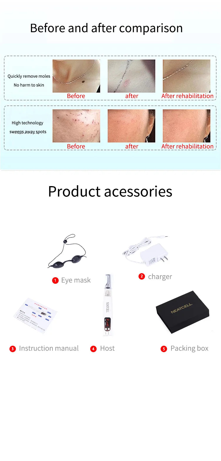 Picosecond Laser Pen for Tattoo Removal and Skin Care - EU/US/UK Plugs Relaxation Treatment Tidesmit