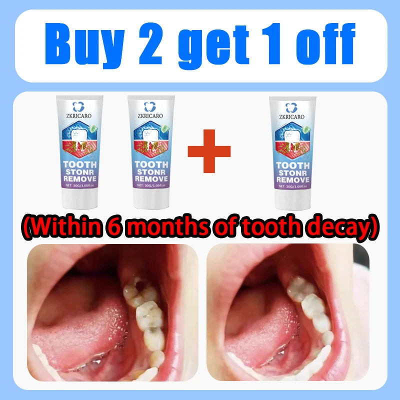 Tooth Decay Repair Treatment | Natural Mineral Enamel Gel | Tidesmit Scrubs Treatments Buy 2 Get 1 Free Tidesmit