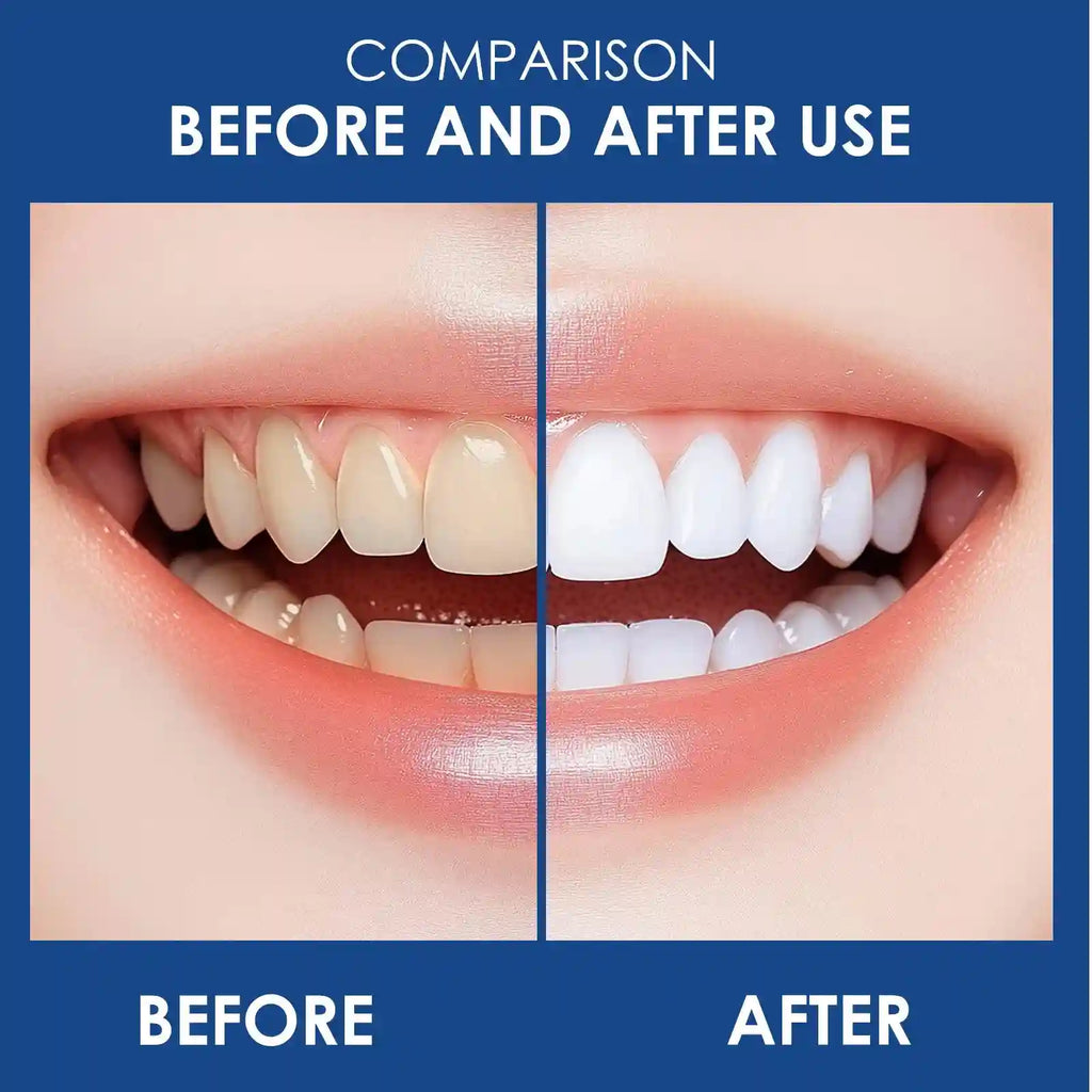 Tidesmit 10% Hydroxyapatite whitening toothpaste for deep cleaning and enamel strengthening