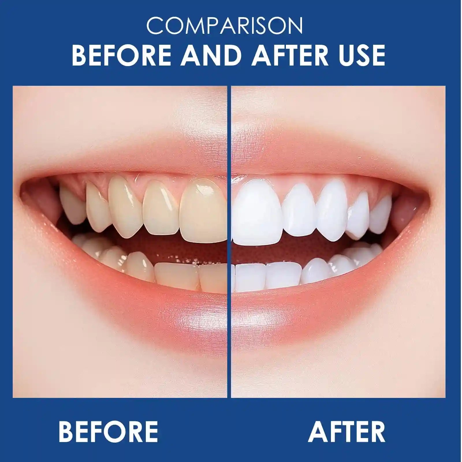 Tidesmit 10% Hydroxyapatite whitening toothpaste for deep cleaning and enamel strengthening