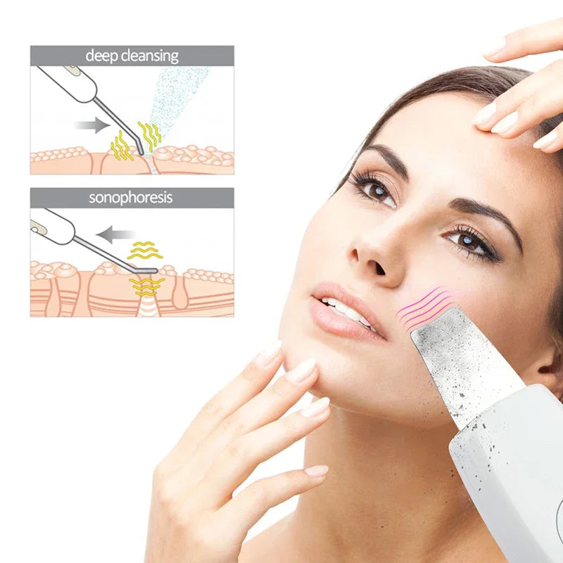 Ultrasonic Skin Scrubber: Pro Deep Pore Cleansing Facial Tool Scrubs Treatments Tidesmit