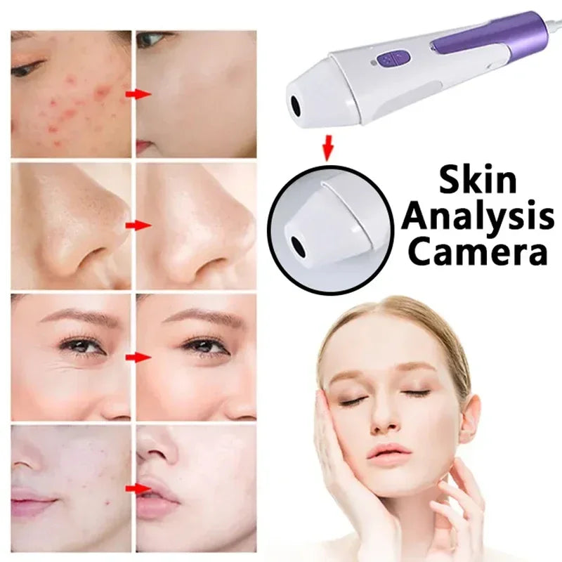 Hydro Dermabrasion 4-In-1 Facial Machine | Tidesmit Spa Grade System Massage Chairs Tidesmit