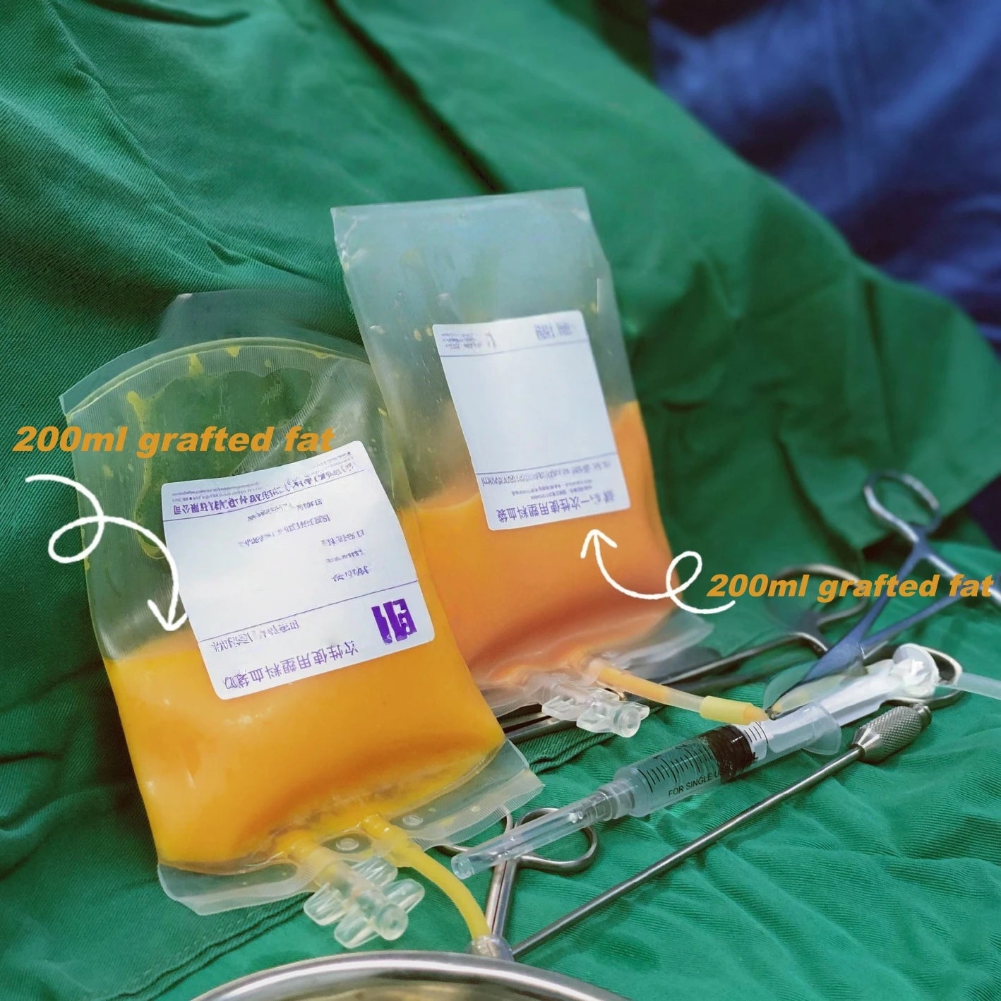 Stromal Vascular Fraction Gel Kit | Metal Cylinder | Tidesmit Body Shaping Massage Equipment Tidesmit