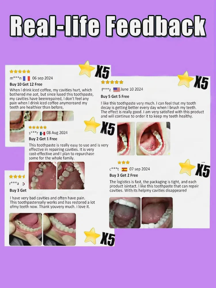 Tidesmit probiotic teeth whitening treatment for tooth decay repair and deep enamel cleaning
