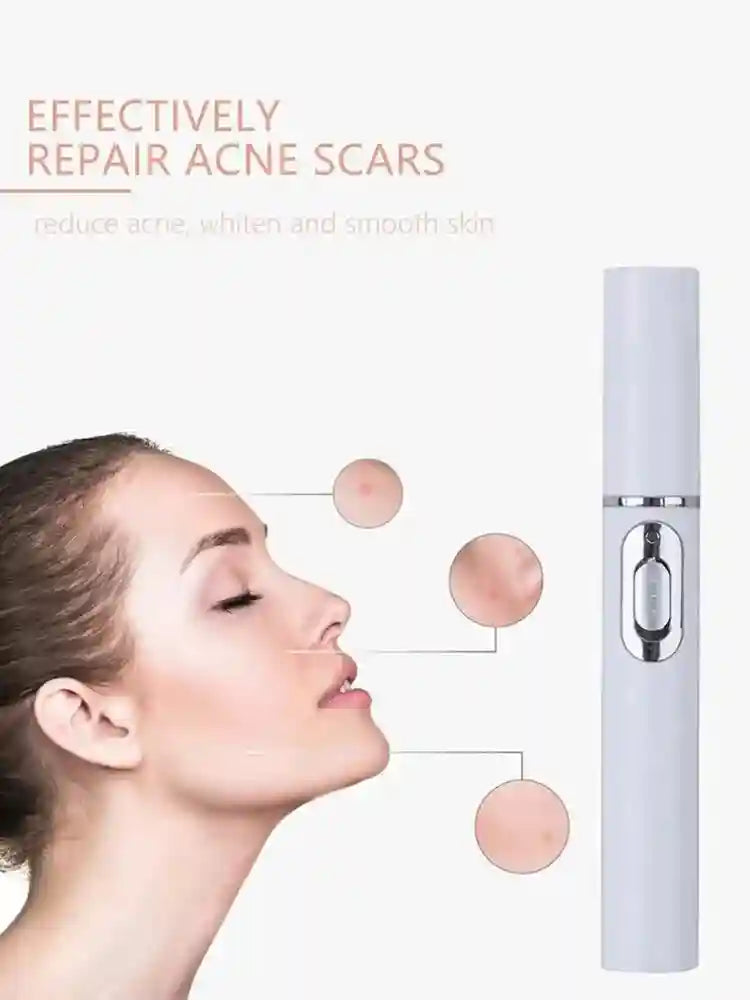 Eye Massage Instrument - Sonic Vibration Device for Dark Circles (White) Eye Massage Instrument Tidesmit