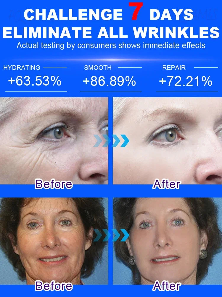 wrinkles disappeared