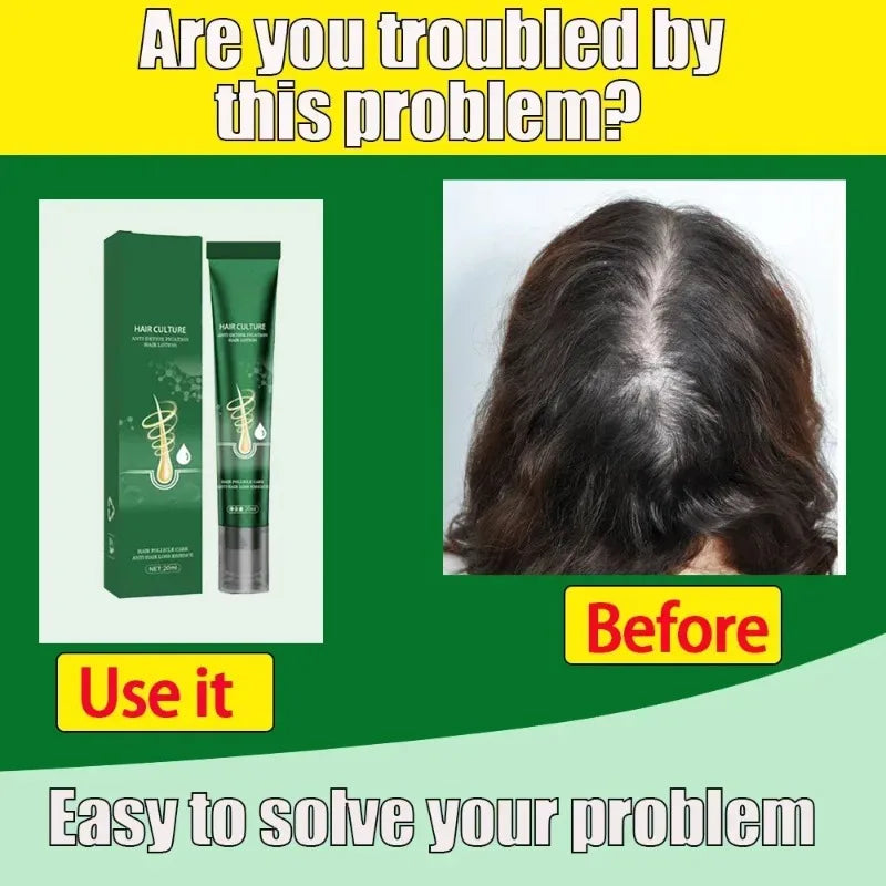 Biotin Hair Growth Oil for Thicker Hair | Natural Scalp Treatment Scrubs Treatments Tidesmit