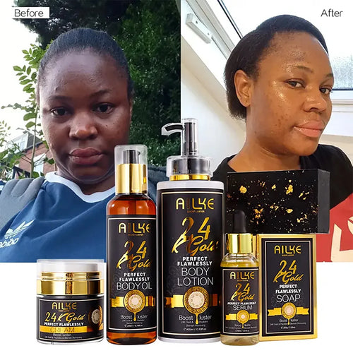 Ailke 24k Gold anti-inflammatory serum and skincare set in black and gold packaging for skin brightening.