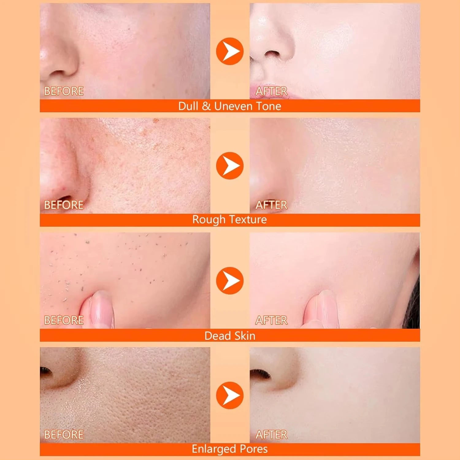 Body Keratin Care Kojic Acid Turmeric Spray Gently Exfoliating Peeling Solution Brightening Hydrating Skin Care All Skin Types