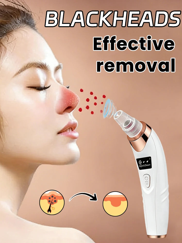 White and rose gold handheld electric facial vacuum pore cleaner used on a woman's nose to remove blackheads.