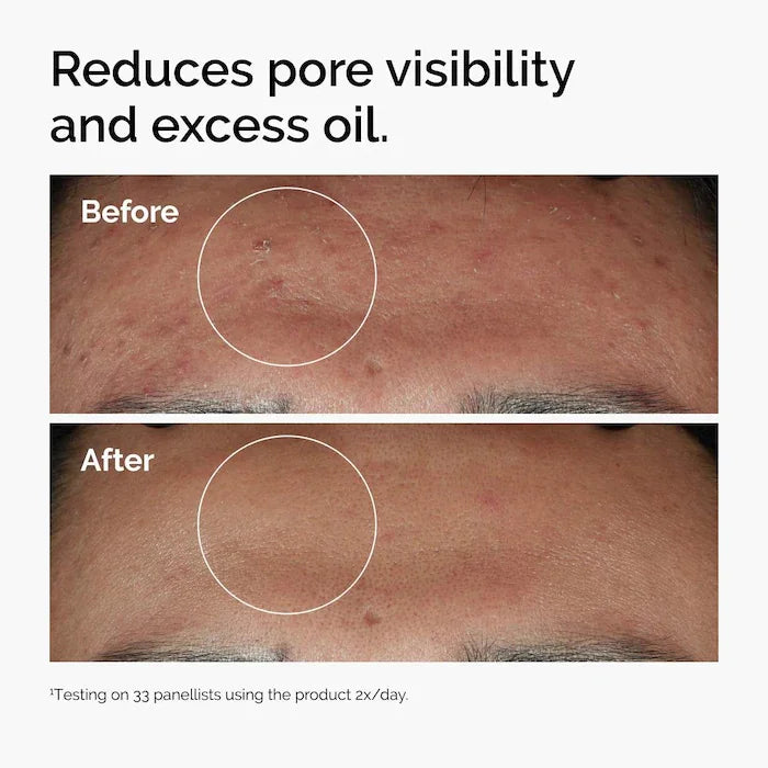 Niacinamide 10% + Zinc 1% Serum 30ml Enhance Skin Brightness Improve Texture Reduce Excess Oil Strengthen Skin Moisture Barrier