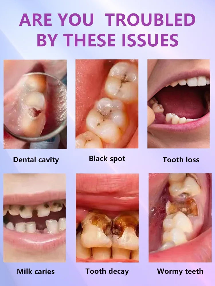 Tidesmit teeth whitening and anti-caries gel for tooth decay repair and cavity protection