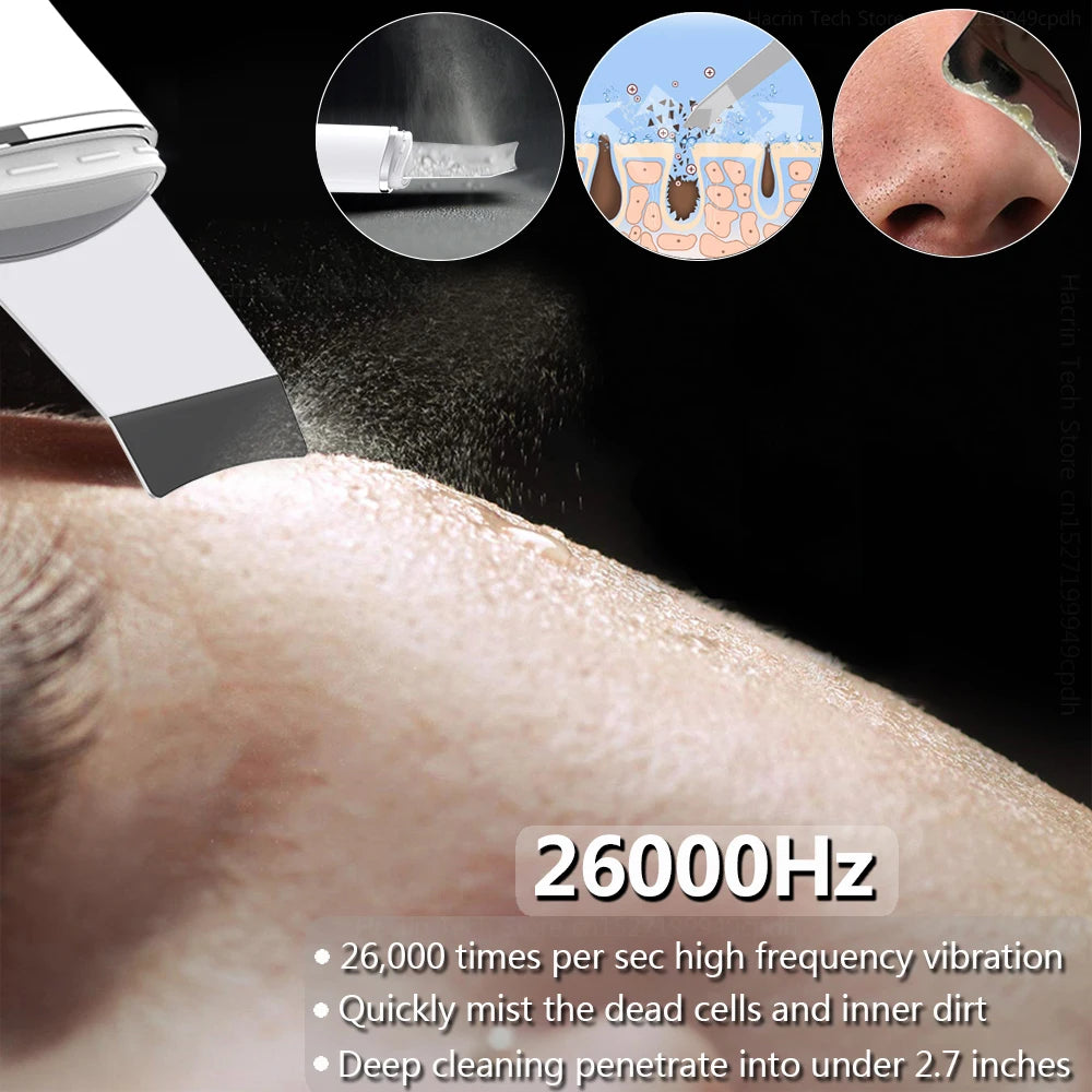 Ultrasonic Face Scrubber - Deep Pore Cleaning & Blackhead Removal Device Scrubs Treatments Tidesmit