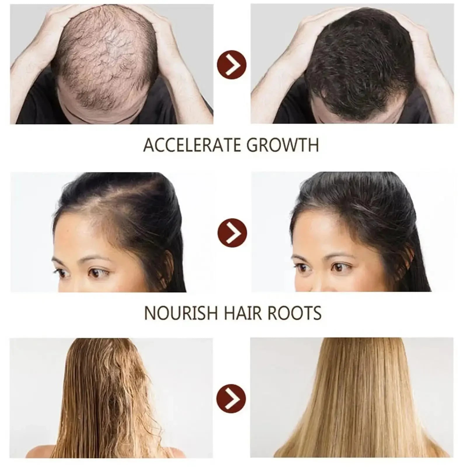 Tidesmit hair growth serum capsules for fast regrowth, anti-hair loss, scalp treatment, and damaged hair repair.