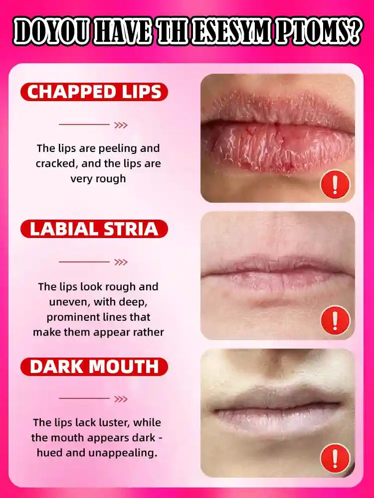 Lip Plumper Serum | Natural Moisturizing Lip Treatment | Tidesmit Lip Care Tidesmit