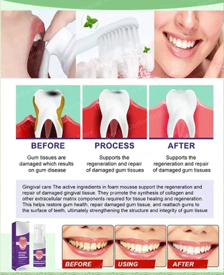 Tidesmit teeth whitening and cavity repair kit for plaque removal and stain protection