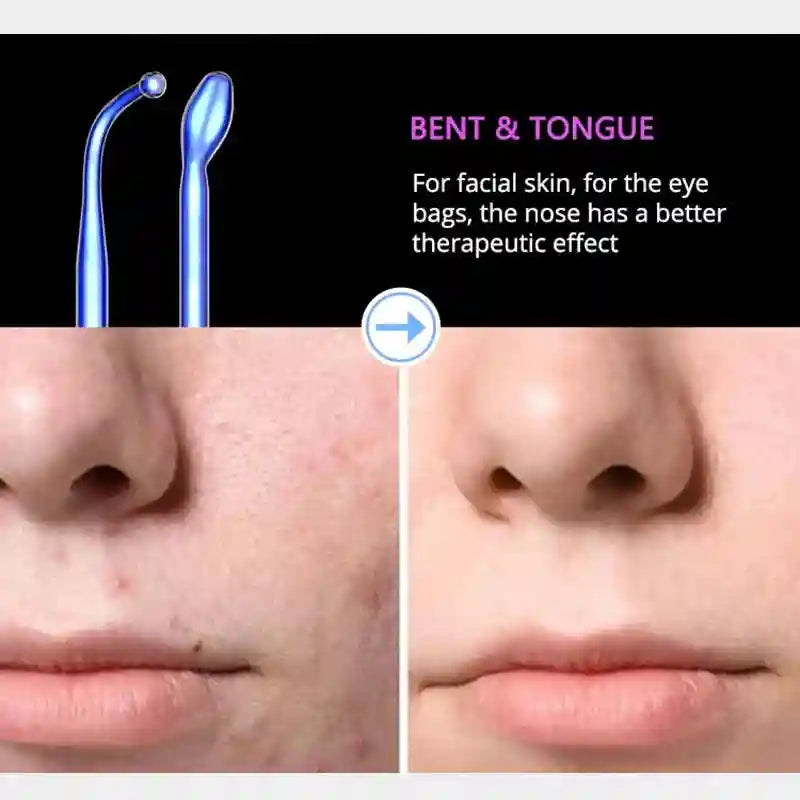 High Frequency Facial Machine - 6-in-1 Professional Skin Therapy Wand Eye Massage Instrument Tidesmit