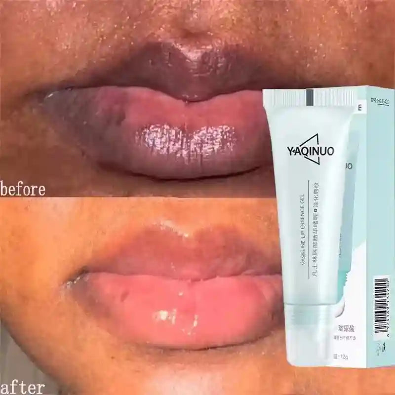 Lip Lightening Balm - Exfoliating Moisturizer for Dark Lips | Tidesmit Lip Care 1PCS Tidesmit