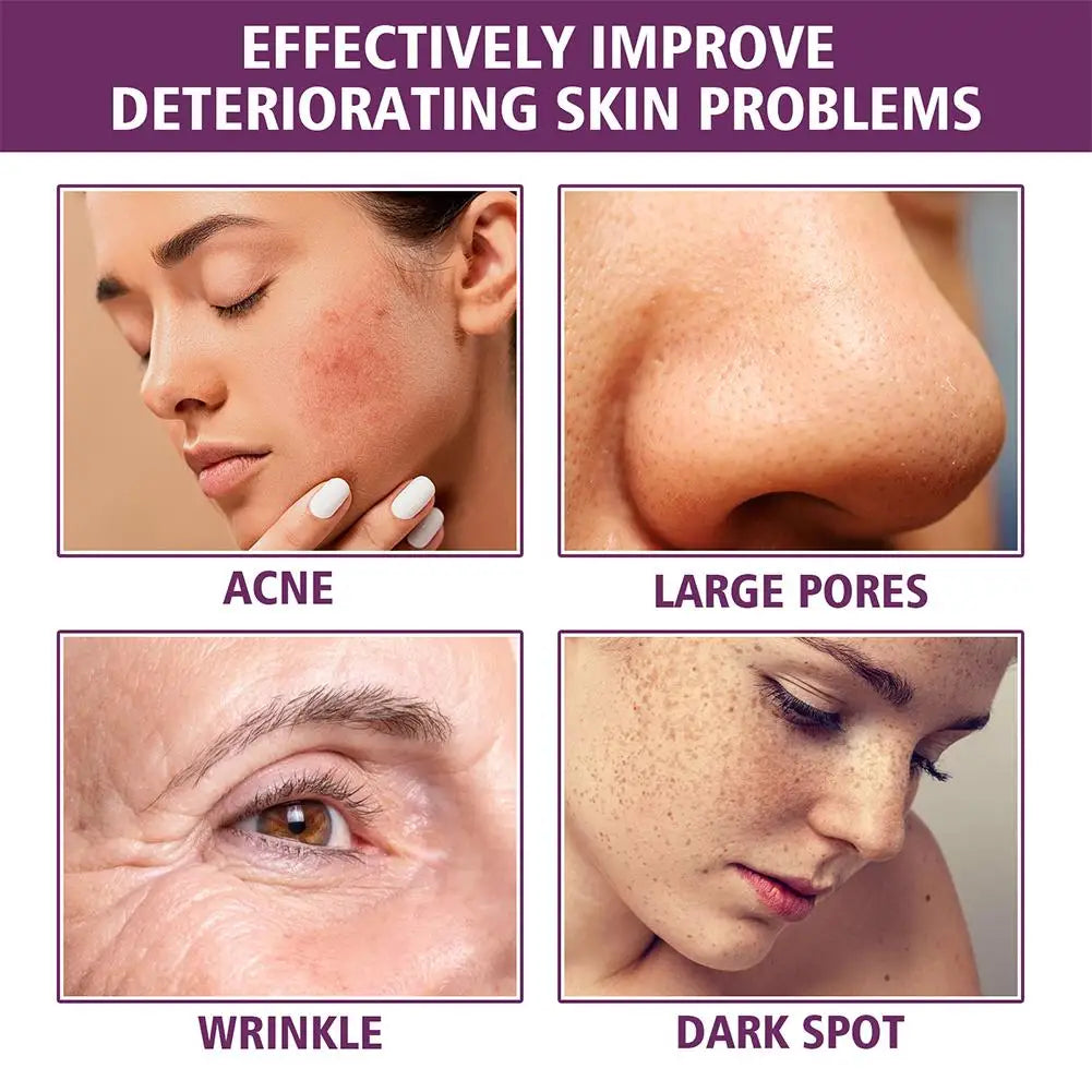 Niacinamide Serum 20% High Concentration Formula Serum Brightens Lightens Spots Niacinamide Care Serum Lifts Nasal Lines