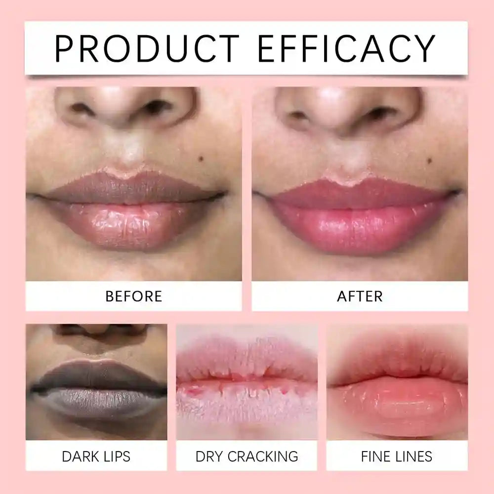 Dark Lip Lightening Balm: Moisturizing Treatment by Tidesmit Lip Care Tidesmit