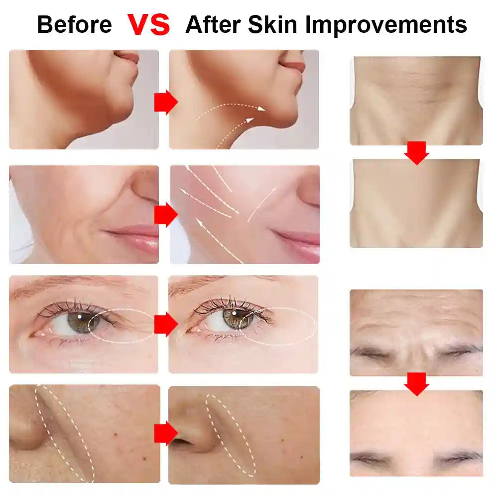 Hifu Face Lifting Machine | Microcurrent Skin Rejuvenation Tool Eye Massage Instrument Tidesmit